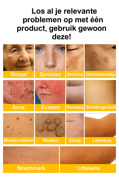 Bee Venom Anti-Aging Crème – Liftende & Verstevigende Crème | Hydrateert, Vermindert Rimpels & Stimuleert Collageen – Voor Alle Huidtypes